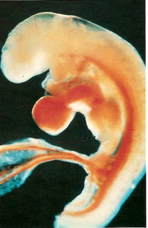 sangre número aluminio Imágenes edad gestacional | Aborto. La información médica