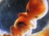 embrion-10-sem-tercer-mes.jpg