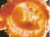 embrion-11-sem.jpg