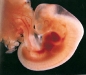 embrion-3-sem.jpg