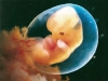 embrion-4-sem.jpg