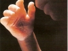 feto-20-sem-5-meses.jpg